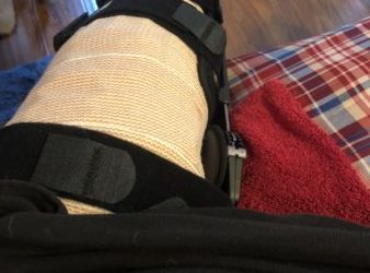ACL Post-Op 2 hours
